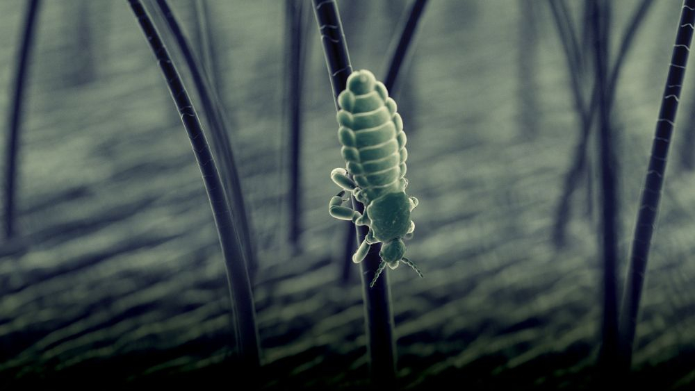 El tratamiento de la pediculosis