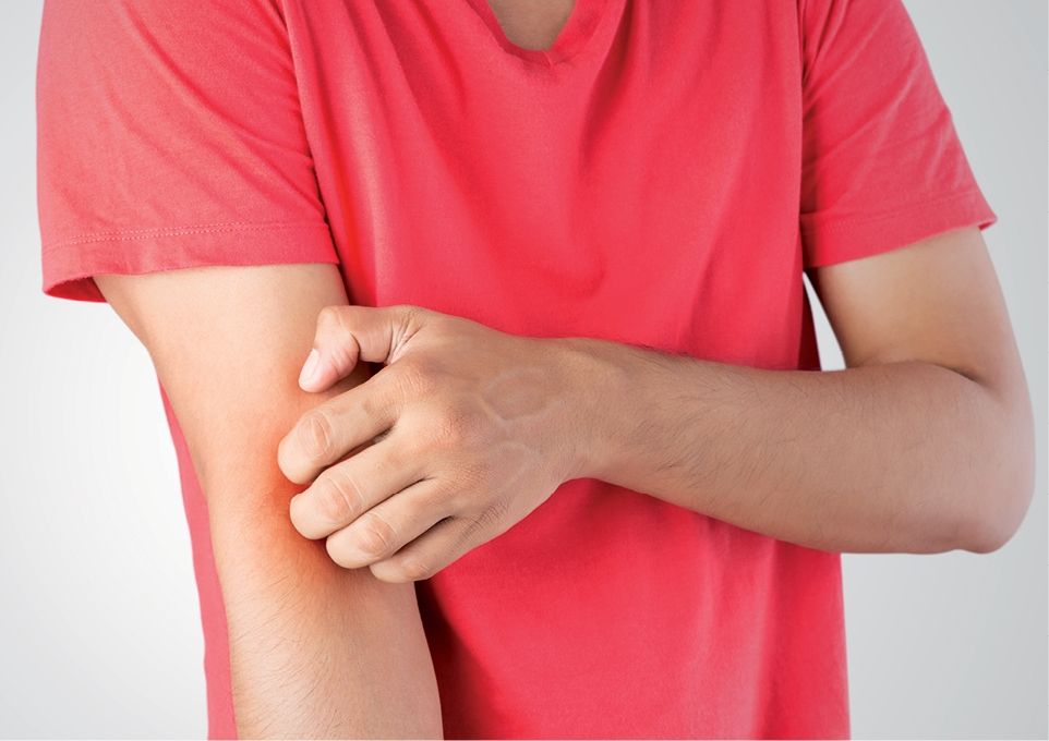 Cuáles son los beneficios y los riesgos de la fototerapia para la  dermatitis atópica?